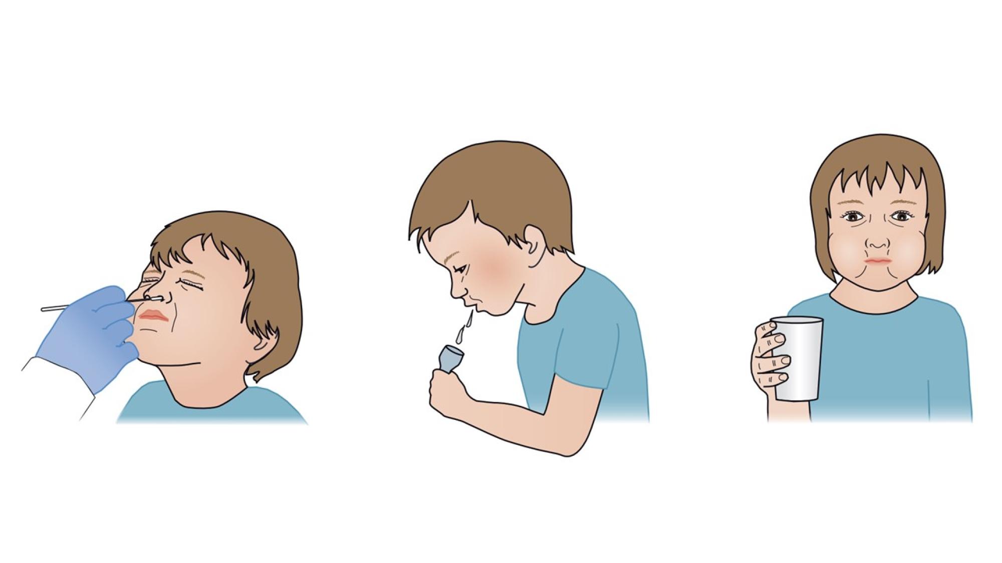 Piirroskuvassa havainnollistetaan infektionäytteen antamista.